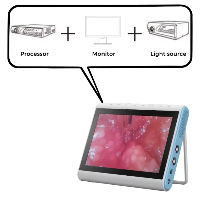3-in-1 Medizinischer Endoskopi – Medical Lab Images Bewertung und Preis